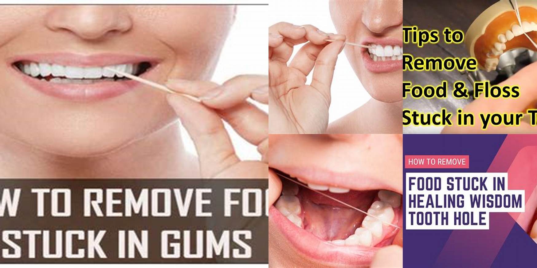 How To Remove Food Stuck Under Gums