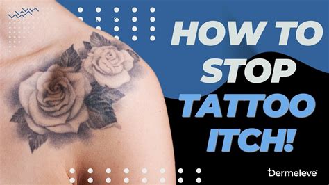 How to stop tattoo itching >