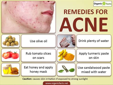 Top 10 Natural Remedies For Getting Rid Of Acne And Blemishes Infographic