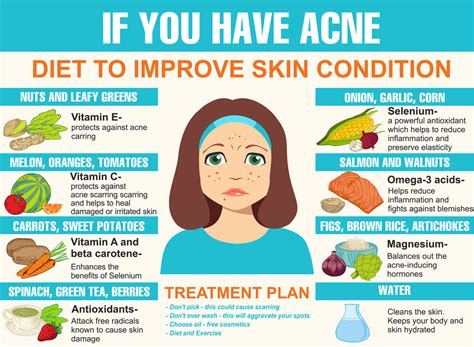 AntiAcne Food Eat Healthy To Heal Acne Infographic