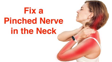 How to Relieve Pinched Nerve in Neck