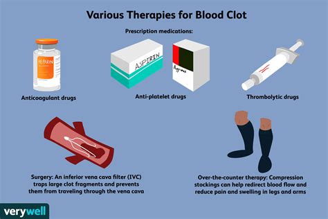 How to Treat Blood Clots