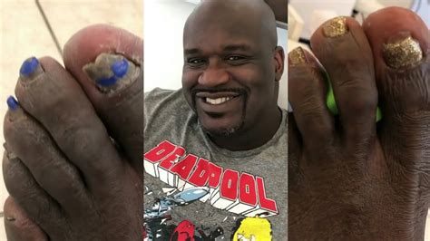 How Big Is Shaquille O Neal Feet