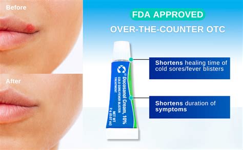 How Blister Cream Works Its Magic