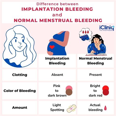 How Does Implantation Bleeding Look Like