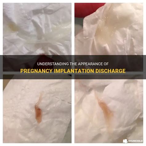 How Does Implantation Discharge Look Like