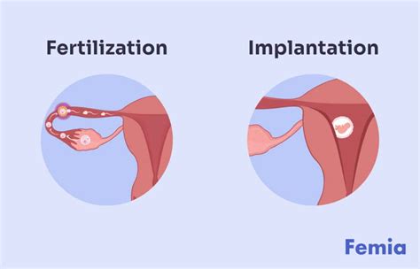 How Does Implantation Look Like