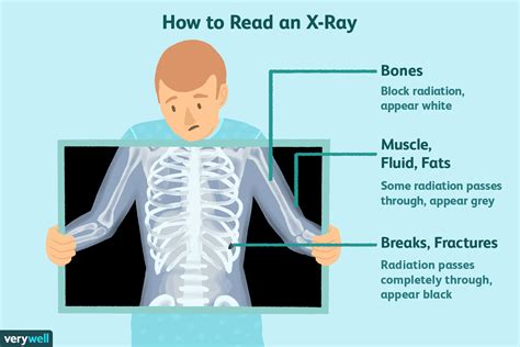 Unveiling the Mystery: The Ultimate Guide to Unraveling How Long X Ray Results Take