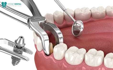 False Teeth Timeline