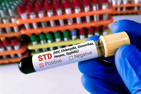 STD Testing