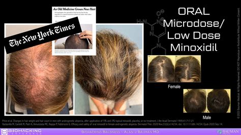 How Oral Minoxidil Works