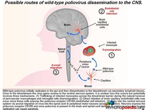 How Poliovirus Spreads: Understanding Transmission