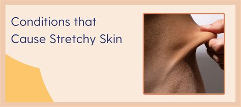 Exploring the Elasticity of Normal Skin: A Comprehensive Guide