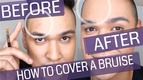 How To Cover Bruises With Makeup