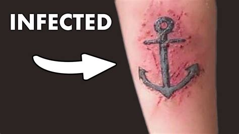 How To Cure An Infected Tattoo