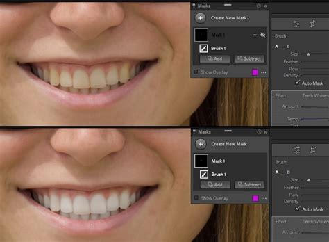 How To Do Teeth Whitening In Lightroom Catalog