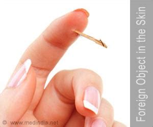 Unleashing the Artistry of Skin First Aid: Mastering the Skill of Extracting Foreign Objects from Skin