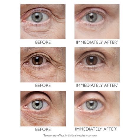 Rejuvenate Your Gaze: Learn the Easy Tips on How to Firm Under Eye Skin