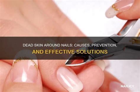 Revive Your Nails: Say Goodbye to Dead Skin with These Expert Tips