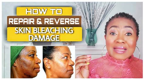 10 Effective Ways To Remove Bleach Stains From Skin