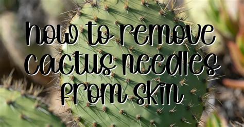 The Pain-free Solution: Learn How to Easily Remove Cactus Spines from Your Skin