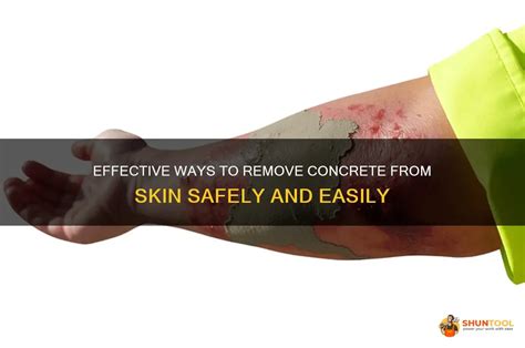 Solve the Stubborn Dilemma: Learn How to Effortlessly Remove Concrete Residue from Your Skin!