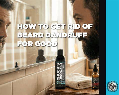 How To Get Rid Of Beard Dandruff