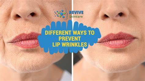 How To Get Rid Of Top Lip Lines