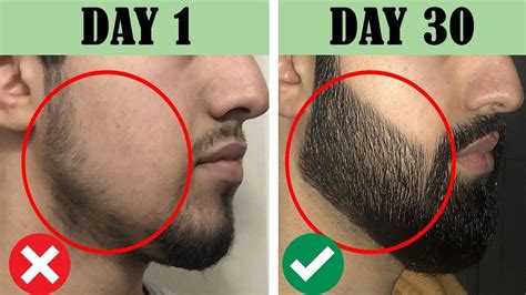 How To Grow Beard On Cheeks
