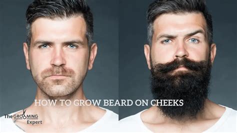How To Grow Beard On Cheeks Naturally