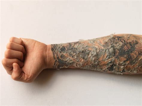 How To Heal A Tattoo Infection