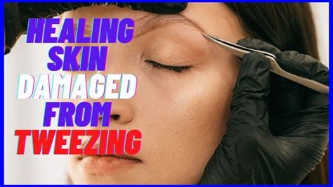 Restore Your Confidence: The Ultimate Guide to Healing Skin Damaged from Tweezing