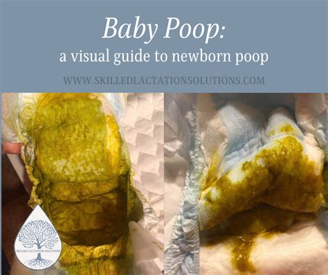 10 Ways to Help Your Baby Poop with Ease and Comfort