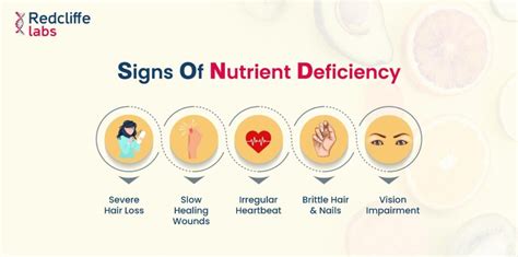 How To Identify Common Nutritional Deficiencies