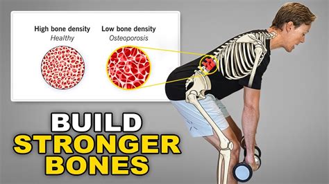 How To Improve Bone Density With High-Impact Training