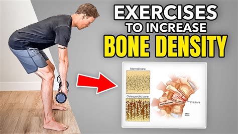 How To Improve Bone Density With Strength Training