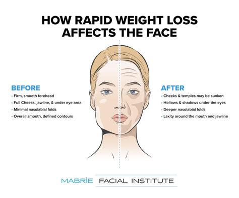 Get a Slimmer Look: Ultimate Tips on How to Lose Weight in your Face Fast