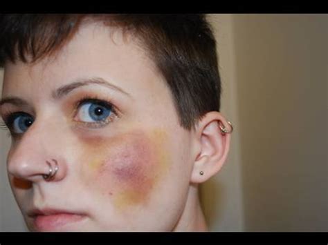 How To Make A Bruise Makeup