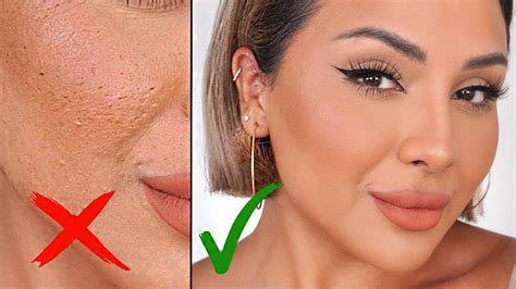 Expert Tips for Smoothing Bumpy Skin with Foundation