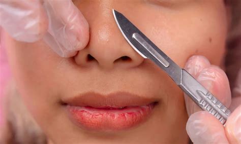 Unlock Smooth & Radiant Skin: Discover Top Tips on How to Prep Your Skin for a Premium Dermaplaning Experience!