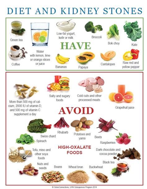 How To Prevent Kidney Stones With Proper Diet
