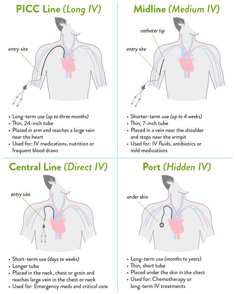The Ultimate Guide: How To Pull A Picc Line Safely and Effectively
