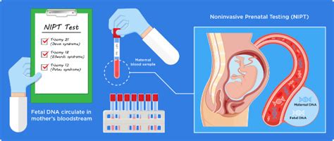Understand Your Baby's Gender with NIPT Test Results