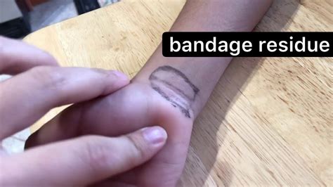 Unveil Silky Skin: Say Goodbye to Sticky Bandage Residue with These Easy Hacks!