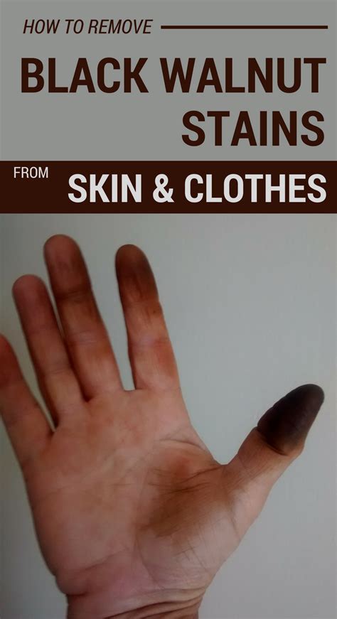 Effortlessly Banish Black Walnut Stains from Skin with These Secret Tips