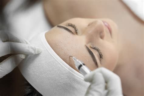 Reveal Your Radiant Skin: The Ultimate Guide to Banishing Dead Skin After Microneedling