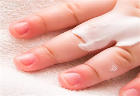 4 Easy Tricks for Banishing Desitin Stains from Your Skin!