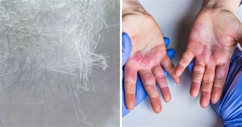 Fiberglass Remorse No More: A Quick Guide on Banishing Resin From Your Skin!