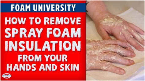 Unfoaming the Impossible: Your Ultimate Guide to Removing Insulation Foam from Skin