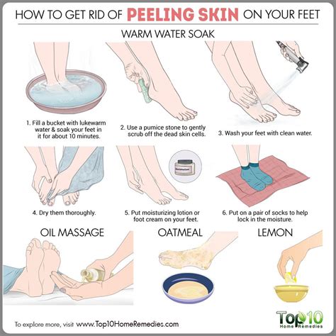 Step Up Your Pedicure Game: Say Goodbye to Peeling Skin on Your Feet with These Expert Tips